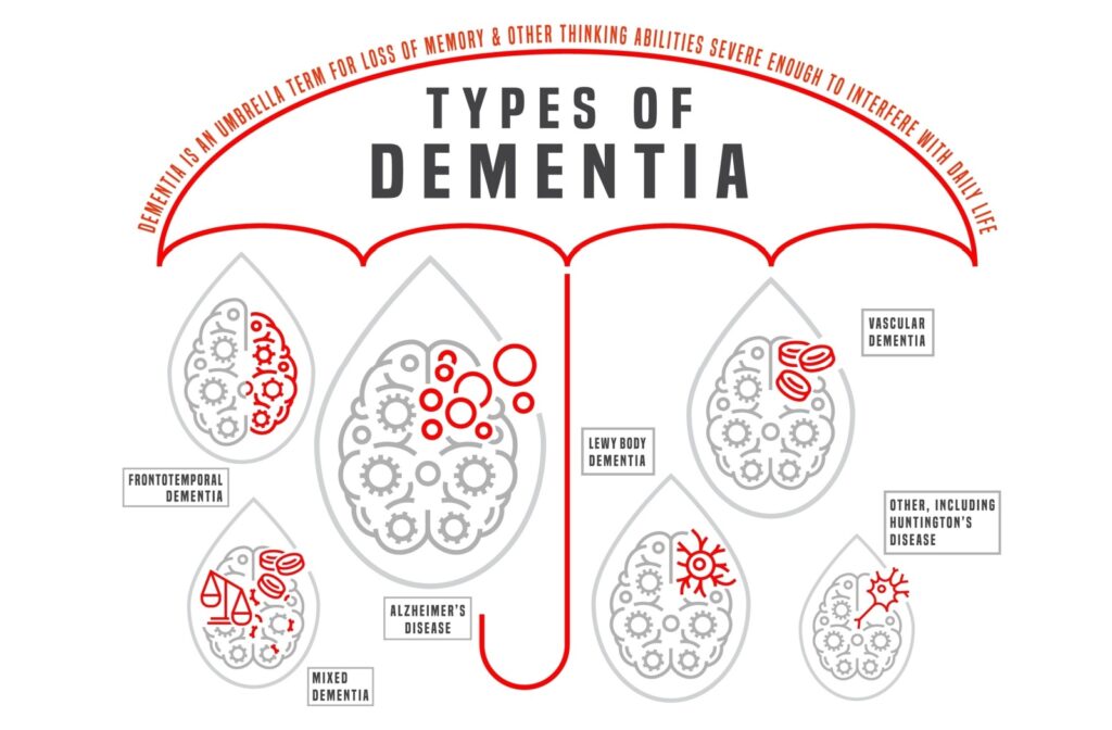 Image showing the different types of dementia.